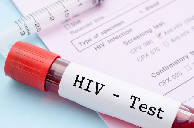 Заболеваемость ВИЧ-инфекцией в Беларуси за январь-июль выросла на 15,6%
